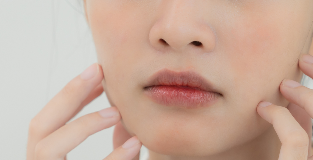 Saat Area Sekitar Mulut Terus Bermasalah, Belum Tentu Jerawat: Kenali Perioral Dermatitis