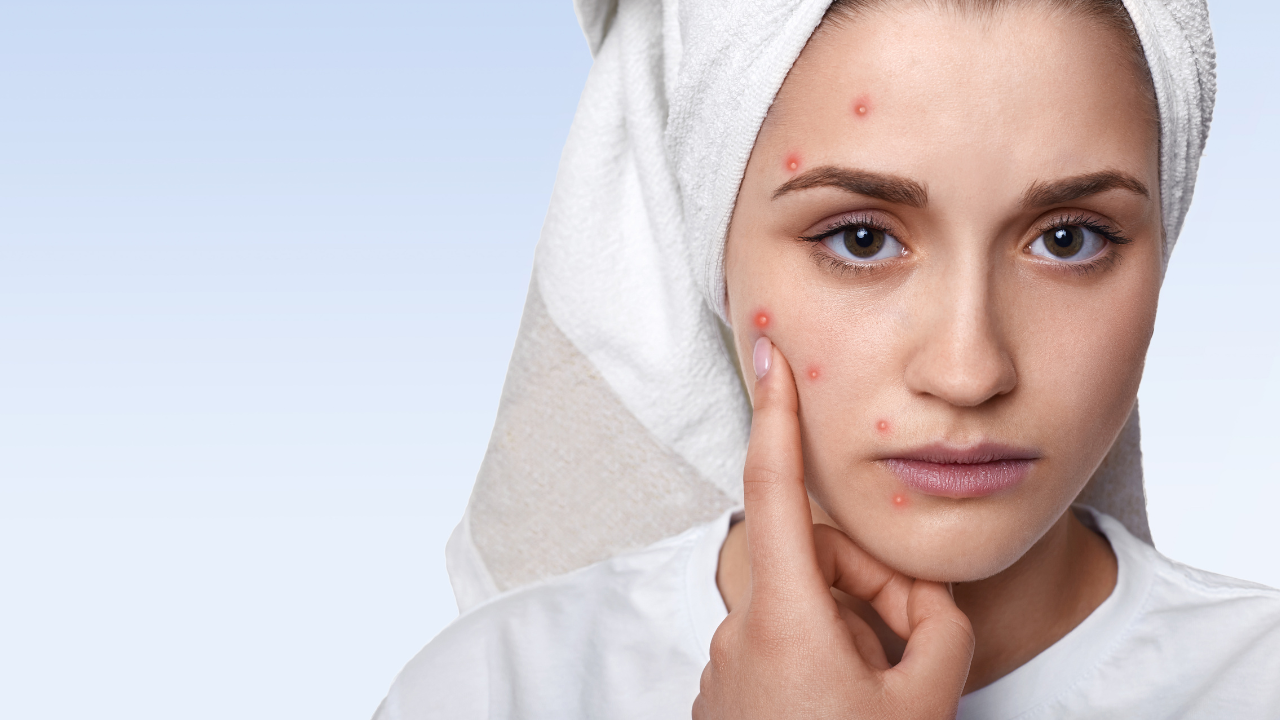Kulit Bruntusan Setelah Pakai Skincare Baru? Cek Beberapa Hal Ini!