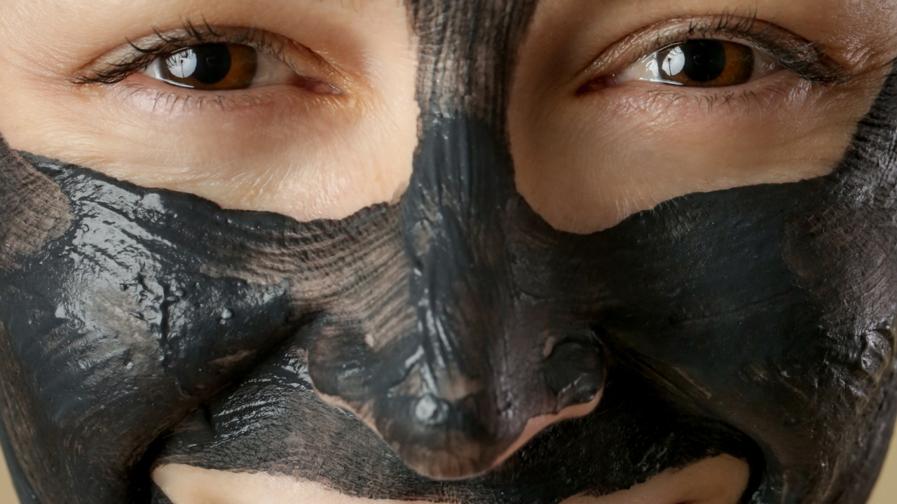 Komedo di Hidung Sulit Hilang? Ini yang Sering Menjadi Penyebabnya